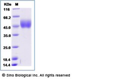 Sino Biological Influenza A H6N1 (A/quail/Hong Kong/1721-30/99) Hemagglutinin