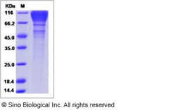 Sino Biological HIV-1 (group M, subtype B, strain SHIV-89.6P) gp120 Protein