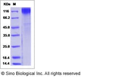 Sino Biological Simian immunodeficiency virus (SIV) (isolate F236) envelope
