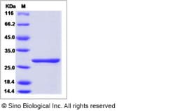 Sino Biological Rift Valley fever virus (TAN/Dod-002/07) RVFV-L Protein