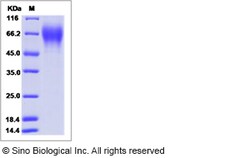 Sino Biological Influenza B (B/Brisbane/3/2007) Hemagglutinin / HA1 Protein