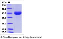 Sino Biological Influenza A H10N7 (A/blue-winged teal/Louisiana/Sg-00073/2007)