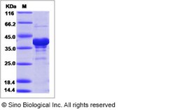 Sino Biological Ebola virus EBOV (subtype Sudan, strain Gulu) VP40 / Matrix