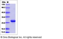 Sino Biological Ebola virus EBOV (subtype Zaire, strain H.sapiens-wt/GIN/2014/Kissidougou-C15)