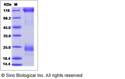 Sino Biological Ebola virus EBOV (subtype Zaire, strain Ebola virus H.sapiens-wt/SLE/2014/ManoRiver-G3686.1)