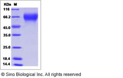 Sino Biological Influenza B (B/Wisconsin/01/2012) Hemagglutinin / HA1 Protein