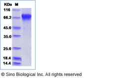 Sino Biological Influenza A H1N1 (A/Albany/12/1951) Hemagglutinin / HA