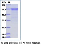 Sino Biological Enterovirus D68 (EV-D68) (strain Fermon) VP1 Protein (Fc