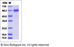 Sino Biological Influenza A H3N2 (A/Netherlands/178/1995) (RG145K) Hemagglutinin