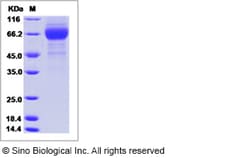 Sino Biological Influenza A H3N2 (A/Philippines/472/2002) (MDCK) Hemagglutinin