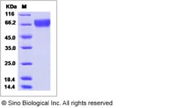 Sino Biological Influenza A H3N2 (A/Fujian/411/2002) Hemagglutinin / HA