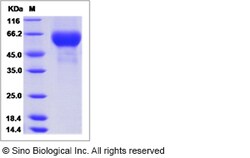 Sino Biological Influenza A H3N2 (A/Hanoi/EL201/2009) Hemagglutinin / HA1