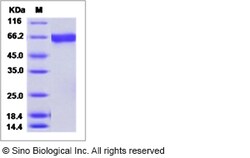 Sino Biological Influenza A H3N2 (A/Missouri/09/2014) Hemagglutinin / HA