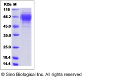 Sino Biological Influenza A H3N2 (A/Missouri/09/2014) Hemagglutinin / HA1
