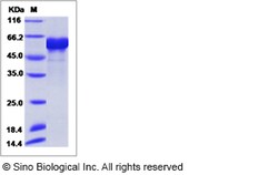 Sino Biological AcmNPV Envelope glycoprotein gp64 / AcmNPV-gp64 Protein