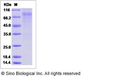 Sino Biological Influenza A H3N2 (A/Switzerland/9715293/2013) Hemagglutinin