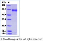 Sino Biological Influenza B (B/PHUKET/3073/2013) Neuraminidase / NA Protein