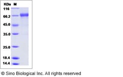 Sino Biological Influenza A H1N1 (A/Memphis/1/1987) Hemagglutinin / HA