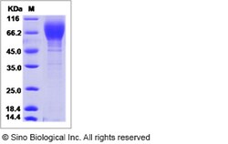 Sino Biological Influenza A H1N1 (A/Memphis/1/1987) Hemagglutinin / HA1