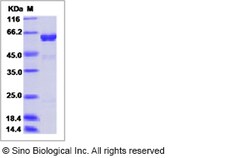 Sino Biological Influenza A H5N8 (A/turkey/Germany-MV/R2472/2014) Hemagglutinin