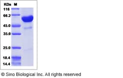 Sino Biological Influenza A H5N2 (A/chicken/Iowa/04-20/2015) Hemagglutinin
