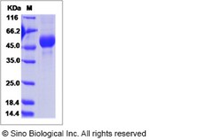 Sino Biological Influenza A H5N2 (A/chicken/Iowa/04-20/2015) Hemagglutinin