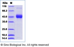 Sino Biological Dengue virus (DENV) (type 1, strain US/Hawaii/1944) DENV-NS1