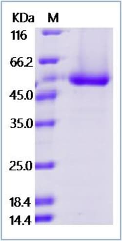 Sino Biological Dengue virus (DENV)(type 3, strain Philippines/H87/1956)