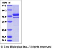 Sino Biological Dengue virus (DENV) (type 4, strain Philippines/H241/1956)