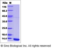 Sino Biological West Nile Virus (WNV) (lineage 2, strain Nea Santa-Greece-2010)