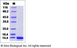 Sino Biological Zika virus (strain Zika SPH2015) E / Envelope protein (Domain