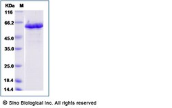Sino Biological Zika virus (ZIKV) (strain Zika SPH2015) ZIKV-NS5 protein