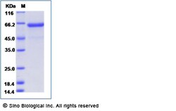 Sino Biological Influenza A H5N6 (A/yunnan/0127/2015) Hemagglutinin / HA