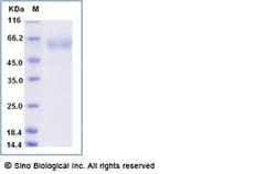 Sino Biological Influenza A H1N1 (A/Michigan/45/2015) Hemagglutinin / HA1