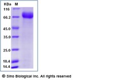 Sino Biological Influenza A H3N2 (A/Hong Kong/4801/2014) Neuraminidase