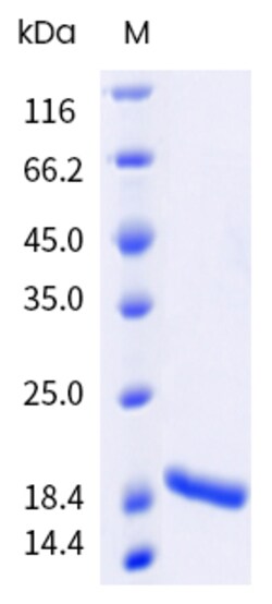 Sino Biological&nbsp;Hepatitis B Virus (HBV)(ayw/France/Tiollais/1979) Capsid protein (His & AVI Tag), Biotinylated 20