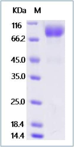 Sino Biological Influenza A H3N2 (A/Singapore/INFIMH-16-0019/2016) Hemagglutinin