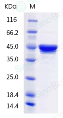Sino Biological SARS-CoV-2 Nucleocapsid (D63G, R203M, D377Y) Protein (His