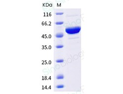 Sino Biological SARS-CoV-2 Nucleocapsid (P13L, R203K, G204R, Q384H) Protein
