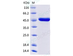 Sino Biological SARS-CoV-2 B.1.1.529 (Omicron) Nucleocapsid Protein (His