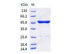 Sino Biological Protein SARS-CoV-2 NP-CoV 100u, Quantity: Each of 1