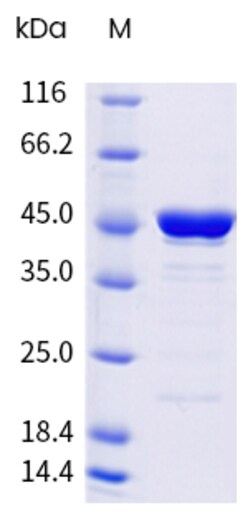 Sino Biological&nbsp;SARS-CoV-2 (XFG) Nucleocapsid Protein (His Tag) 100