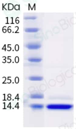 Sino Biological SARS-CoV-2 (2019-nCoV) Nucleocapsid CTD Protein (His Tag)