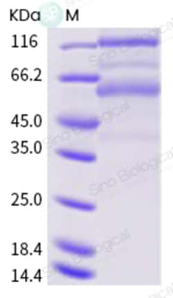 Sino Biological SARS-CoV-2 (2019-nCoV) Spike S1+S2 ECD-His Recombinant
