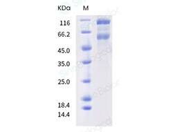 Sino Biological SARS-CoV-2 Spike S1+S2 (Q52R, A67V, HV69-70 deletion, Y144