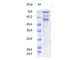 Sino Biological SARS-CoV-2 Spike S1+S2 (L5F, T95I, D253G, S477N, E484K,