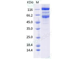 Sino Biological SARS-CoV-2 Spike S1+S2 (G75V, T76I, RSYLTPD246-252 deletion,