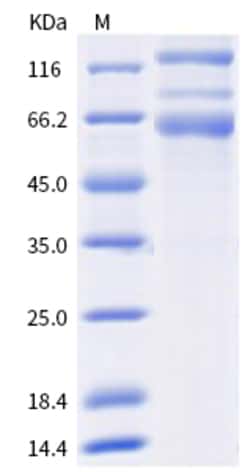 Sino Biological SARS-CoV-2 Spike S1+S2 (T19R, G142D, W258L, K417N, L452R,