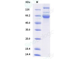 Sino Biological Protein SARS-CoV-2 Spike 100ug, Quantity: Each of 1