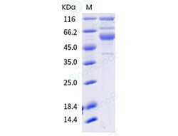 Sino Biological SARS-CoV-2 Spike S1+S2 (T19R, E156G, 157-158 deletion,